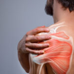 What is Adhesive Capsulitis