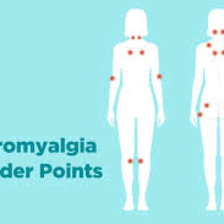 Fighting Fibromyalgia with Physical Therapy