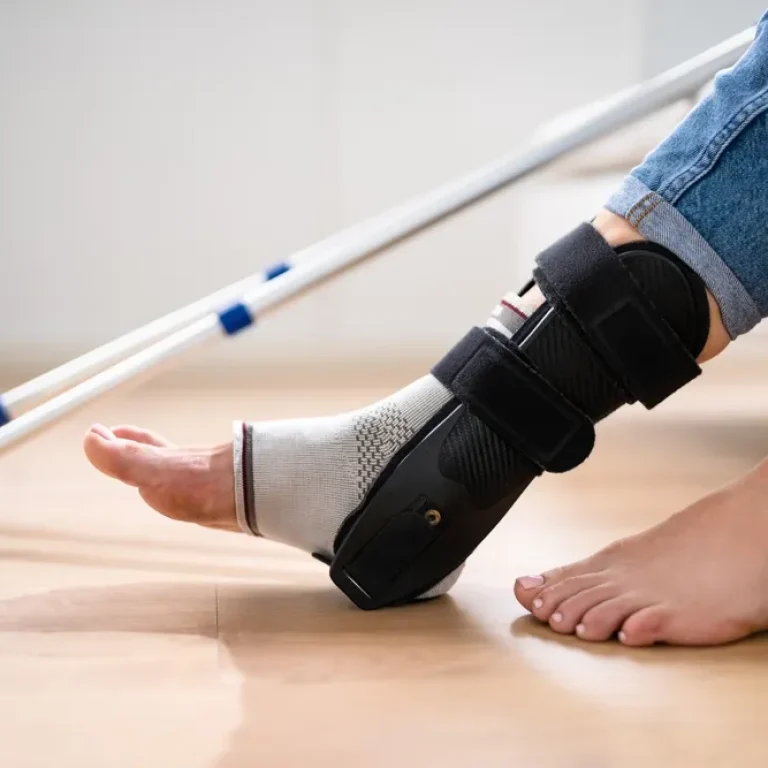 Physical Therapy for Ankle Sprain