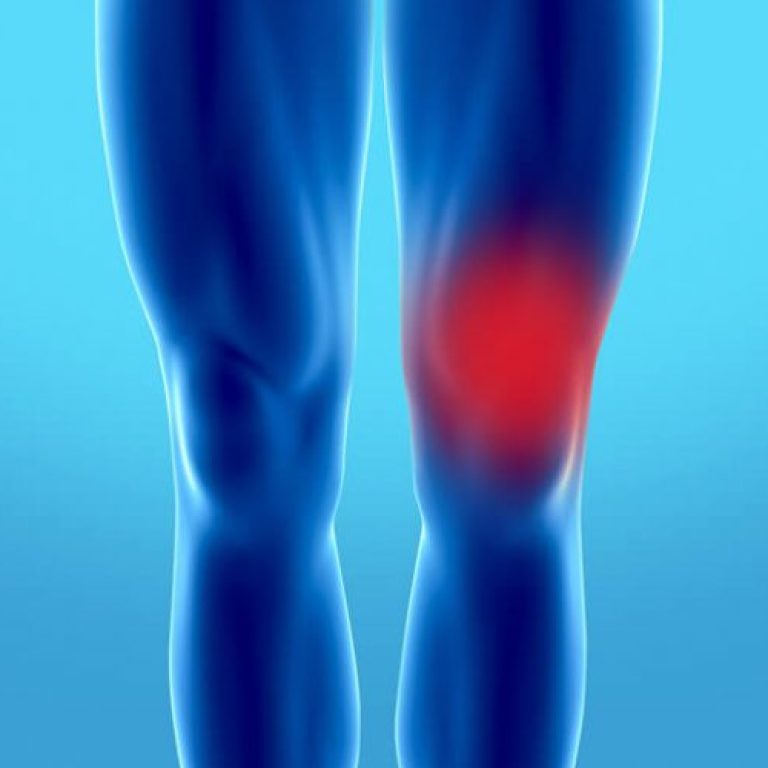 The Truth about Knee Wear and Tear
